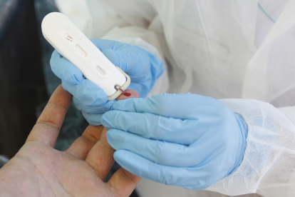 Los casos globales de coronavirus superan los 15 millones, según la OMS