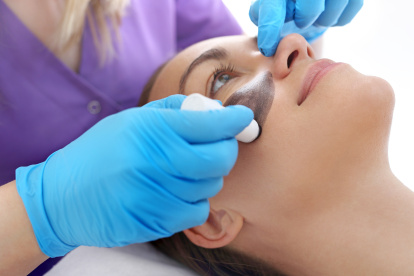 La mascarilla de carbón activado más láser Yang es el tratamiento favorito de las celebridades de Hollywood.