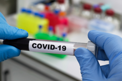 Según datos del Ministerio de Salud Pública (MSP) la semana pasada fue la más alta en casos de COVID-19, desde finales de abril e inicios de mayo.