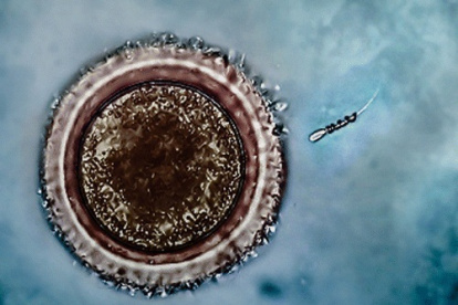 Francesas e italianas, las europeas que más visitan España para someterse a un tratamiento de fertilidad

  (Foto de ARCHIVO)
13/1/2016