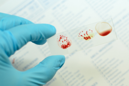 El RBD -que está dentro de la proteína Spike- es la parte del virus que se adhiere a las células huésped.