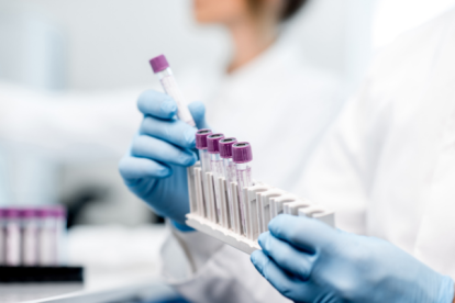 Referencial. La Organización Mundial de la Salud (OMS) señala que sólo se han administrado por ahora en el mundo unos 268 millones de dosis.