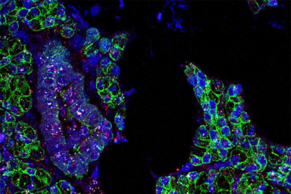 El ARN del SARS-CoV-2 (rosa) y del receptor ACE2 (blanco) encontrados en las células de las glándulas salivales humanas, que se han señalado en verde.