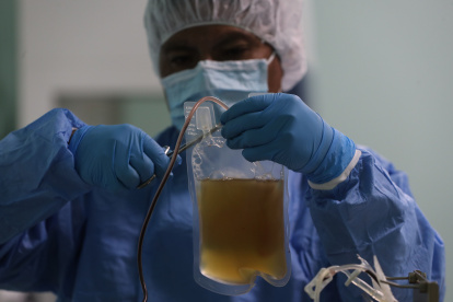 En Bolivia separan el plasma de la sangre de burro para crear un suero hiperinmune.