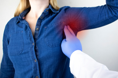 Los ganglios linfáticos