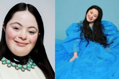 La modelo Ellie Goldstein tiene 19 años.