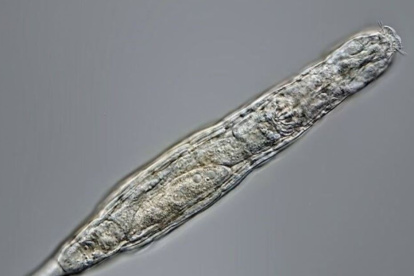 Ejemplar de rotífero.