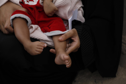 Una mujer sostiene a un niño desnutrido, en Saná, capital de Yemen, el 10 de agosto de 2021