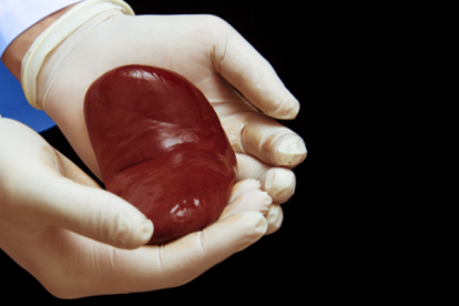 Imagen referencial de un riñón.