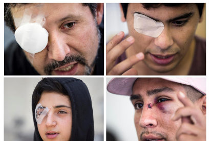 Combo de fotografías de archivo en las que se registró a Álvaro Silva, fotógrafo de 42 años (i-arriba); al estudiante universitario Ariel Flores (d-arriba); al estudiante de secundaria Jordan Fuentes (i-abajo), y al terapeuta Cristian Pozos (d-abajo), todos víctimas de traumas oculares durante la ola de protestas en Chile en 2019.