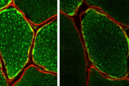 Un equipo de científicos ha identificado una enzima que resulta clave para que el ejercicio mejore nuestra salud. En la imagen, tinción que muestra las mitocondrias dentro de las fibras musculares individuales.