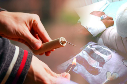 Las fiestas dejaron varios niños quemados por pólvora.