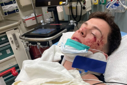 Fotografía cedida por French Toast Agency que muestra al cantante Guaynaa mientras esta ingresado tras un accidente de transporte en Los Ángeles