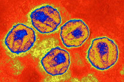 HIV virus. Image produced from an image taken with transmission electron microscopy. Viral diameter around 110 to 125 nm.
