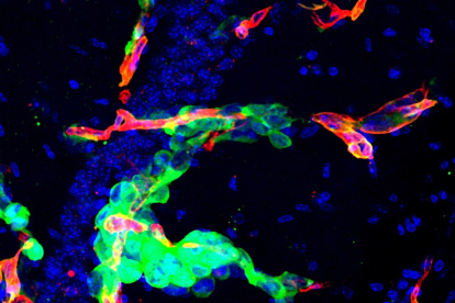 Imagen de la metástasis en cerebro de ratón cedida por el CNIO. En verde, células tumorales que permanecen ‘escondidas’ después de una cirugía y que actúan como potenciales semillas para la reaparición de la metástasis.