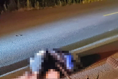 Así quedó el sospechoso luego del enfrentamiento con un policía