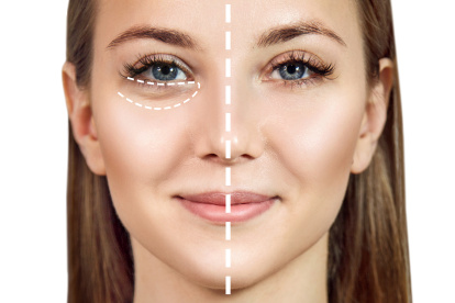 Sáquele el máximo provecho al corrector de ojeras