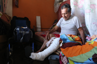 Daño. Desde el 14 de marzo, Reinaldo Acosta permanece con yeso tras caer en una acera, en El Pedregal, en el Guasmo.