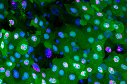 Imagen de la erebosis, un nuevo proceso de muerte celular desconocido hasta ahora y que se produce en los intestinos de la mosca de la fruta.