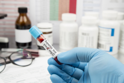 Referencial examen de hepatitis.