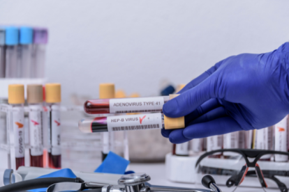 Referencial hepatitis.