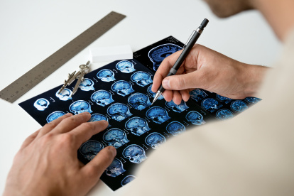 Esta enfermedad afecta más a las mujeres que a los hombres