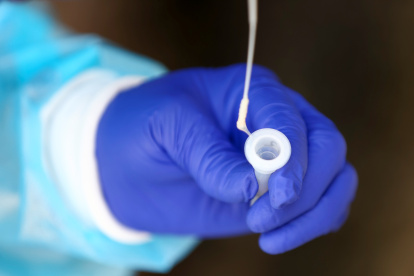 El Ministerio de Salud había indicado que las pruebas rápidas de covid-19 se empezarían a vender en farmacias este miércoles 17 de agosto