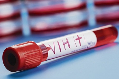 Imagen archivo tubo de ensayo de VIH