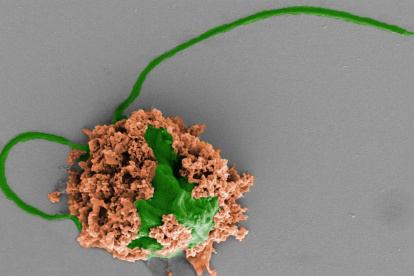 Imagen coloreada de un microrobot que está formado por una célula de alga (verde) recubierta de nanopartículas de polímero biodegradable (marrón).