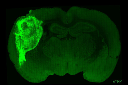 Un organoide humano trasplantado y marcado con una proteína fluorescente en una sección del cerebro de la rata.