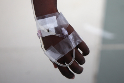 Detalle de una mano de un paciente con síntomas de cólera, en una fotografía de archivo.