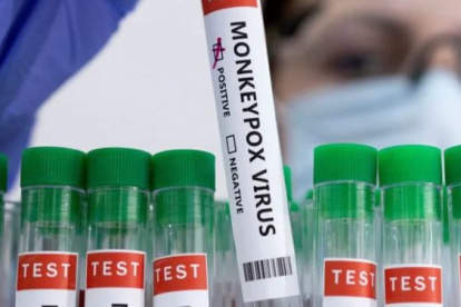 Foto archivo viruela del mono