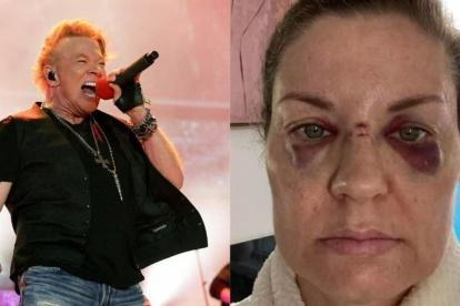Axl Rose lamenta lo ocurrido a una de sus admiradoras, pero aclara que lanzar el micrófono es un "ritual" que realiza hace 30 años.