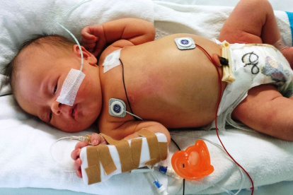 Los expertos urgen a extremar las medidas preventivas y evitar exponer a los menores a aglomeraciones