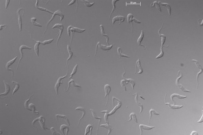 Células de ‘Trypanosoma brucei’ en cultivo observadas al microscopio
