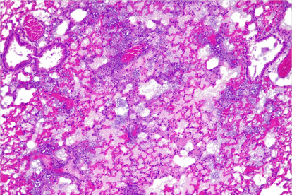 Pulmones de ratón sin píldora activa.