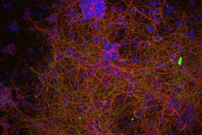 Centros de investigación de seis países europeos han lanzado un proyecto pionero en el mundo para tratar de encontrar tratamientos eficaces contra las lesiones medudales. Imagen microscópica de células neuronales. Imagen cedida por el Instituto de Ciencias Materiales de Madrid (ICMM-CSIC).