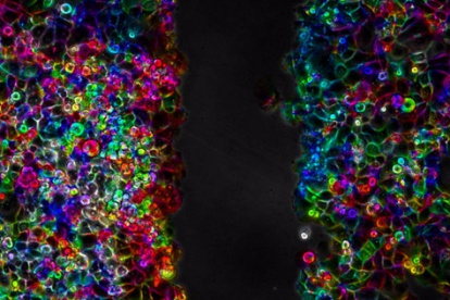 Células de cáncer de páncreas durante un proceso de migración celular. Imagen cedida por el Instituto de Tecnologías Físicas y de la Información Leonardo Torres Quevedo (ITEFI) del Consejo Superior de Investigaciones Científicas.