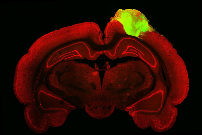 Imagen histológica de un cerebro de rata con un organoide cerebral humano injertado.