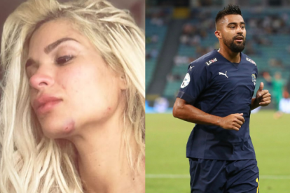 En las imágenes publicadas por la modelo se observa su rostro golpeado y con raspones