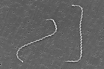 La Leptospira es la bacteria causante de esta enfermedad.