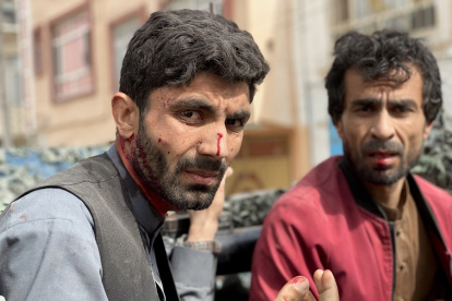 Dos de los periodistas heridos en el atentado.