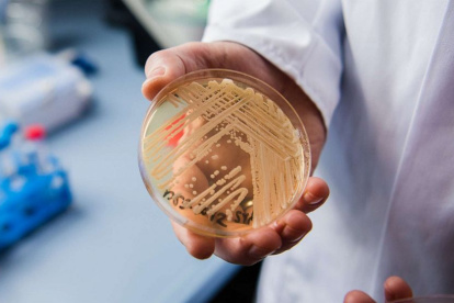El director del Centro Nacional de Referencia para Infecciones Invasivas por Hongos, Oliver Kurzai, sostiene una placa de Petri que contiene la levadura "Candida auris".