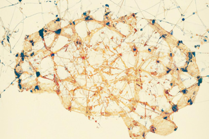 Los síntomas de la esquizofrenia suelen comenzar entre los 16 y 30 años. I