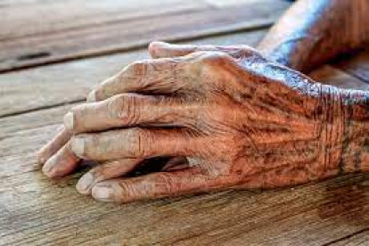 Evidencia. La piel envejecida  cicatriza deficientemente.