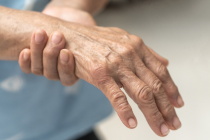 El Síndrome de Guillain Barré causa debilidad en miembros superiores e inferiores.