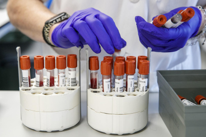 Imagen de archivo de personal técnico de laboratorio preparando unas muestras para analizar.