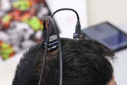 Detalle de una sesión del ensayo clínico en el cerebro de un hombre que sufría tetraplejia.