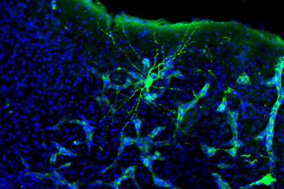 Metástasis en cerebro de ratón. Se aprecia cómo la metástasis (verde más claro) interacciona con una neurona (verde más intenso). Esta neurona está marcada específicamente para su estudio, pero la metástasis está interaccionando con muchas más.