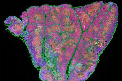 Sección de tejido completo de un timo humano después del nacimiento, que muestra timocitos (rojo), células epiteliales (cian) y células madre junto a zonas de fibronectina (verde).